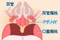 図:アデノイド・扁桃
